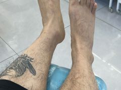 -世龙世家甲沟炎·灰指甲·嵌甲矫正·修脚(武侯区双楠店)