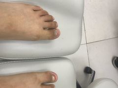 -新甲连锁灰指甲·甲沟炎·鸡眼(黑龙江路店)