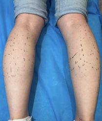 -杭州米兰柏羽医疗美容医院