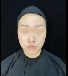 -洁铭新加坡医美