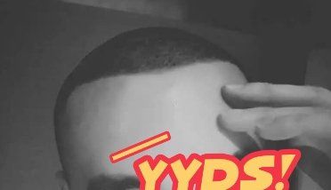 -大麦微针植发丨全国连锁