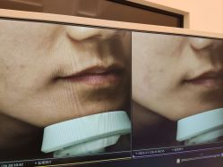 -苑苑vbeauty科技美容SPA