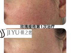 -七彩云南第壹城