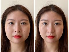 -FACE·日本小颜美容整骨(福田店)