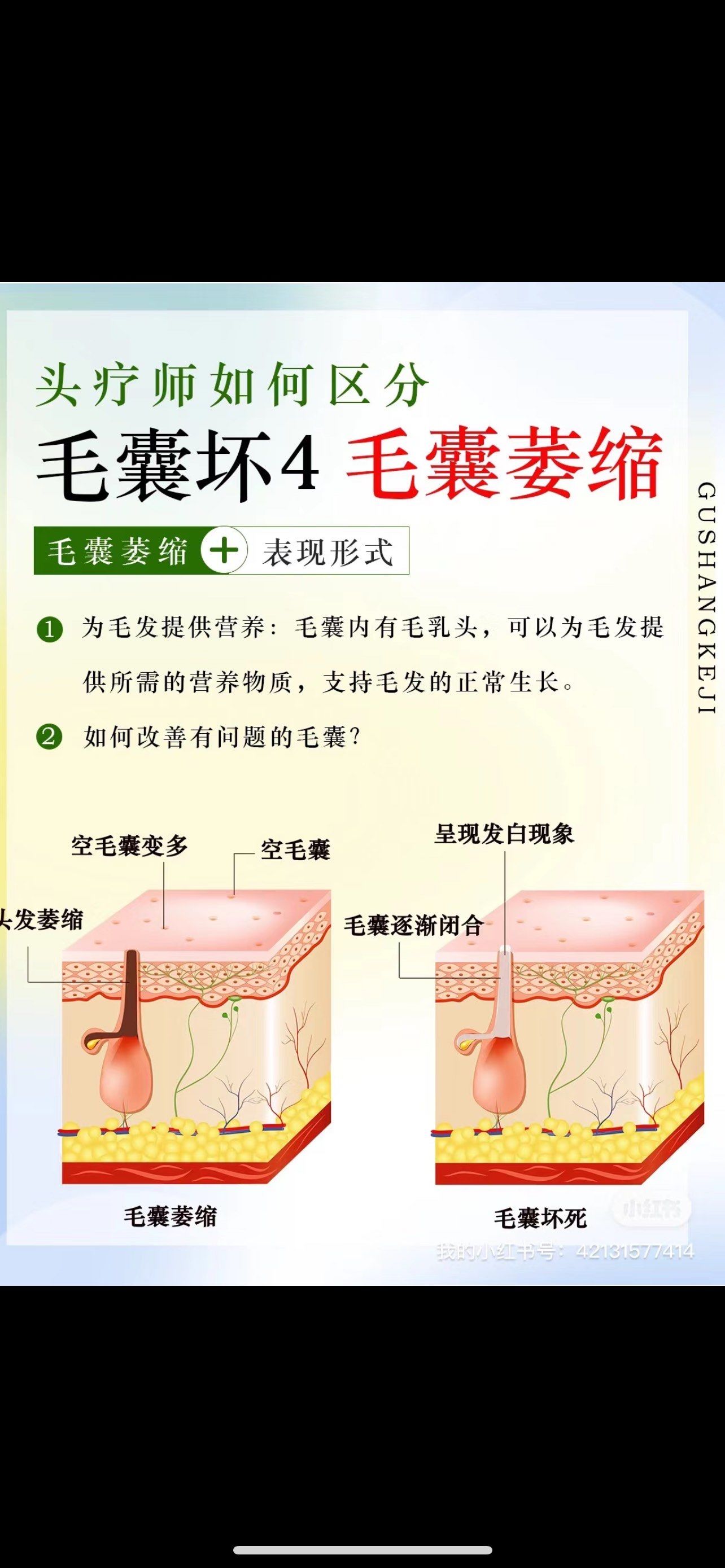 它包围着毛发的根部,为毛发提供稳定的生长环境!