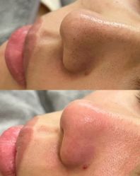 -瓷肌博士·祛痘科技美肤