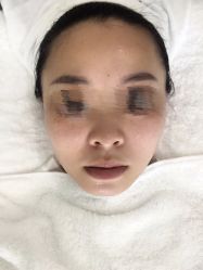 体验后-贞禾医美·连锁