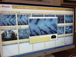 -丝客富脱发养发头皮馆