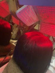 -碧莲盛·不剃发植发