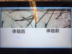 体验前-杭州医巢医疗美容