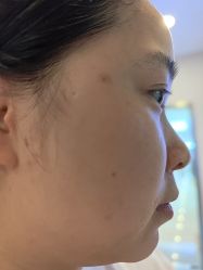 -长沙雅美医疗美容医院