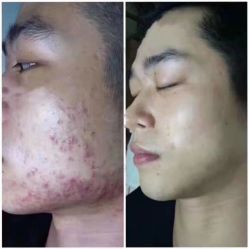 -ROYEA茹彦祛痘·问题肌肤修护中心