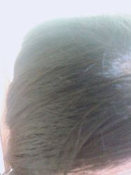 -髻尚坊增发补发织发假发定制