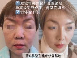 -北京米扬丽格医疗美容·联合丽格鼻整形中心