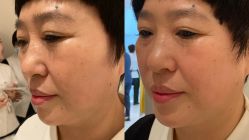 -安吉拉青春化管理中心