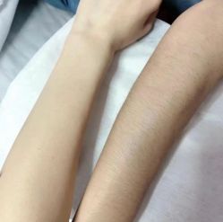 -咪咪比基尼脱毛专业店