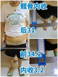 -蓝丝带产后恢复中心(都江堰店)