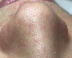 -悦肌YJ FOR FACE皮肤管理中心