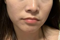 -上海伊莱美医疗美容医院