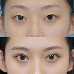 -上海伊莱美医疗美容医院