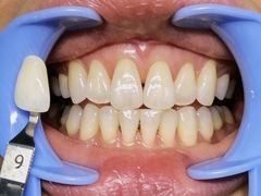 -极光口腔·矫正种植修复(锦江院区)