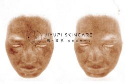 点击看大图 -MLP美丽派·问题肌疗愈中心