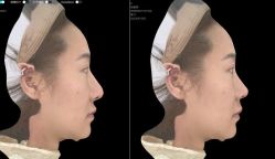 体验后-深圳广和门诊部·整形医疗美容