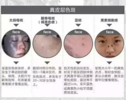 -上海漾颜医疗美容