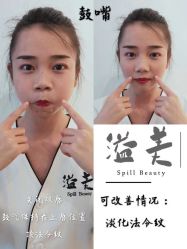 -溢美古法抗衰