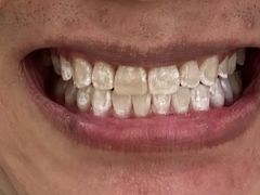 -圣贝口腔(海淀店)