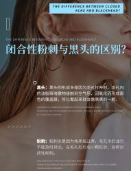 -美肤盾祛痘·问题肌头疗管理中心