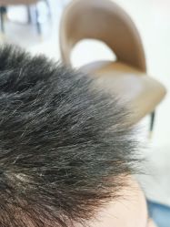 点击看大图 -新生植发·植养护一体