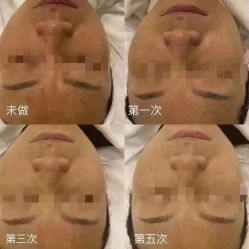 -YESIDO椰岛美容
