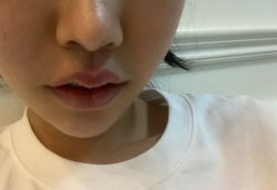 -小忠丽格医美