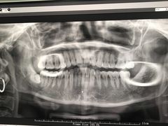 -牙博士口腔(杨浦店)