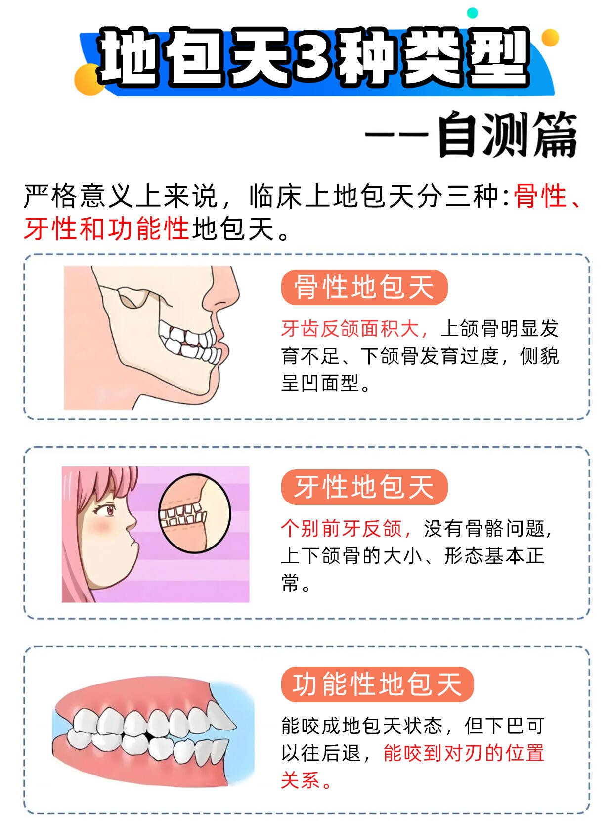 地包天严重程度划分图图片