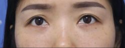-天津健丽·去眼袋医疗美容机构
