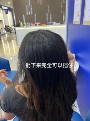 -大麦微针植发全国连锁