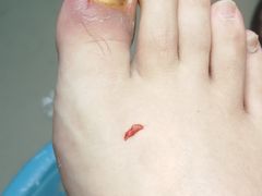 -世龙世家甲沟炎·灰指甲·嵌甲矫正·修脚(武侯区双楠店)