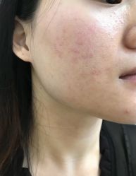 -Boss H Beauty美肌中心