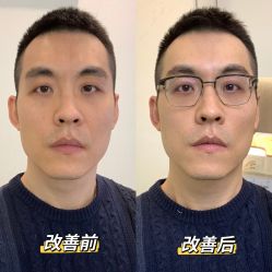 体验前-联合丽格·张菡丽格医疗美容