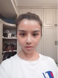 体验后-北京米扬丽格医疗美容·联合丽格鼻整形中心