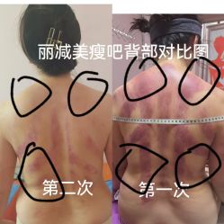 -丽减美瘦吧·减肥瘦身
