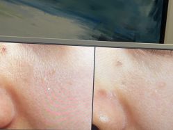 -苑苑vbeauty科技美容SPA
