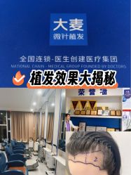 -大麦微针植发全国连锁