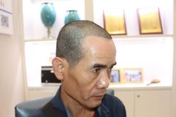 -大麦微针植发丨全国连锁