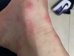 -五七小李子油焖大虾(总店)