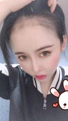 -大麦微针植发丨全国连锁