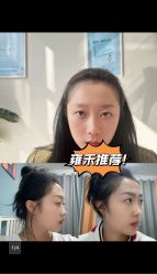 -雍禾植发全国连锁