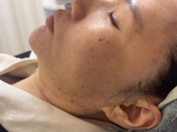 -长沙雅美医疗美容医院